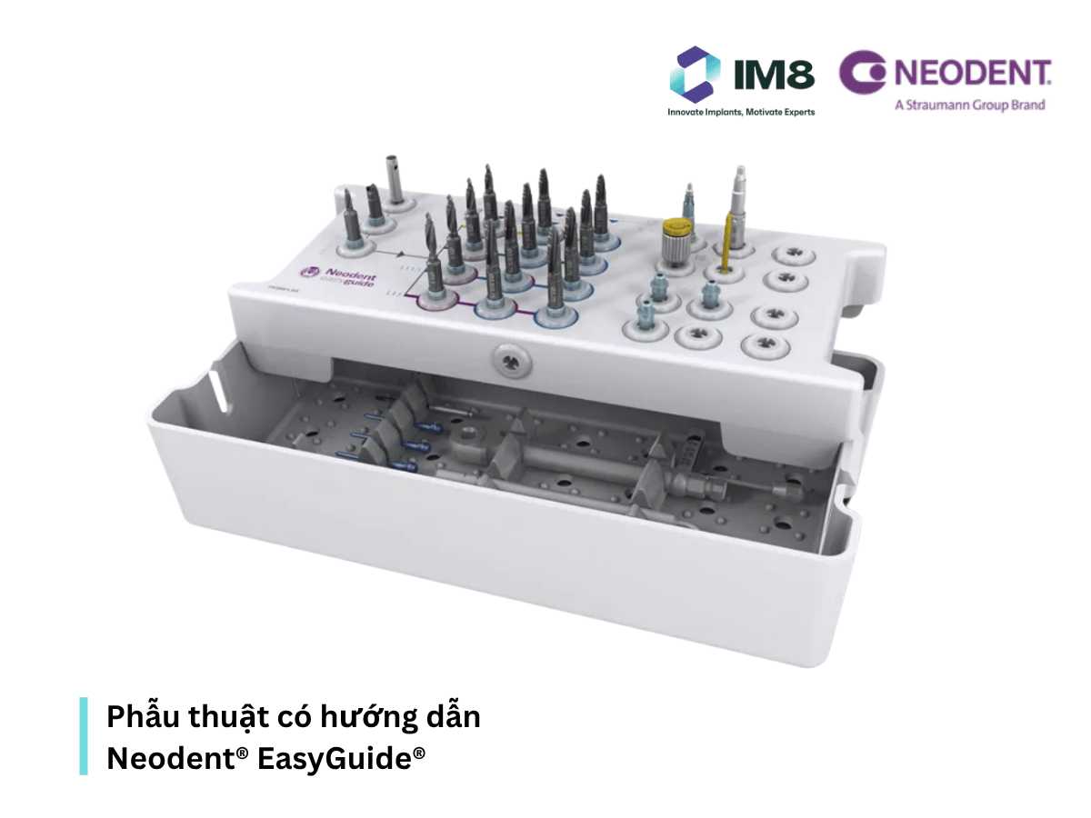 Phẫu thuật có hướng dẫn Neodent® EasyGuide®
